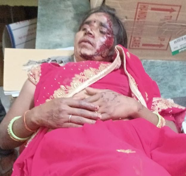 फोटो10एयूआरपी 18- घायल रेखा फोटो10एयूआरपी 18- घायल रेखा