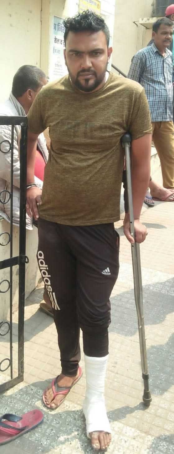 बागेश्वर के क्वैराली में जंगल की आग बुझाने के दौरान घायल हुआ युवक। संवाद न्यूज एजेंसी बागेश्वर के क्वैराली में जंगल की आग बुझाने के दौरान घायल हुआ युवक। संवाद न्यूज एजेंसी