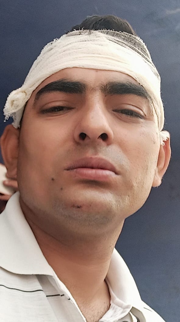 बागपत जनपद के छपरौली थाने में मानसिक रूप से कमजोर युवक के हमले में घायल एसआई देवेंद्र दूबे। संवा? बागपत जनपद के छपरौली थाने में मानसिक रूप से कमजोर युवक के हमले में घायल एसआई देवेंद्र दूबे। संवा?