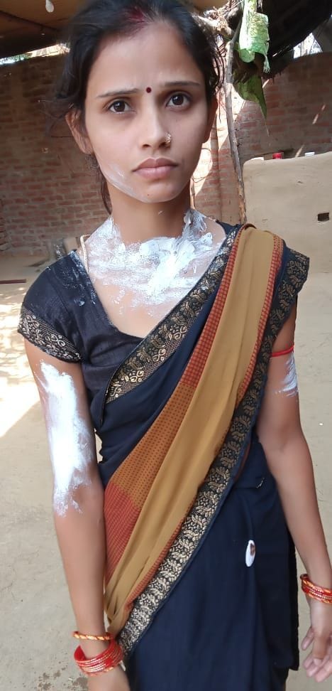 तेजाब से झुलसी मोहिनी देवी। संवाद