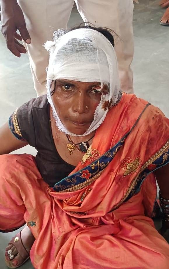फोटो04एयूआरपी-18- घायल शशी। संवाद फोटो04एयूआरपी-18- घायल शशी। संवाद