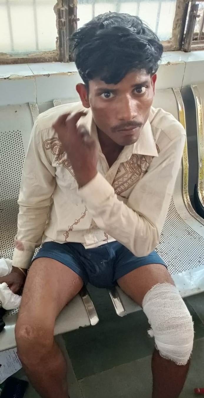फोटो04एयूआरपी-19- घायल मनोज। संवाद फोटो04एयूआरपी-19- घायल मनोज। संवाद