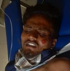 मार्ग दुर्घटना में घायल शिवम। मार्ग दुर्घटना में घायल शिवम।