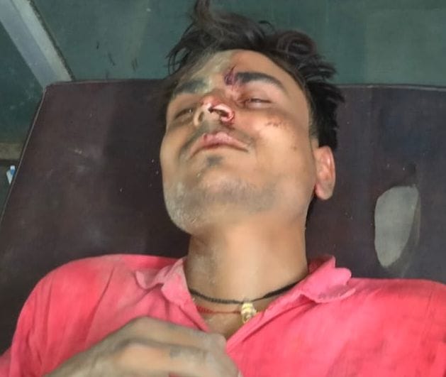 घायल बस यात्री मेडिकल कॉलेज में भर्ती
