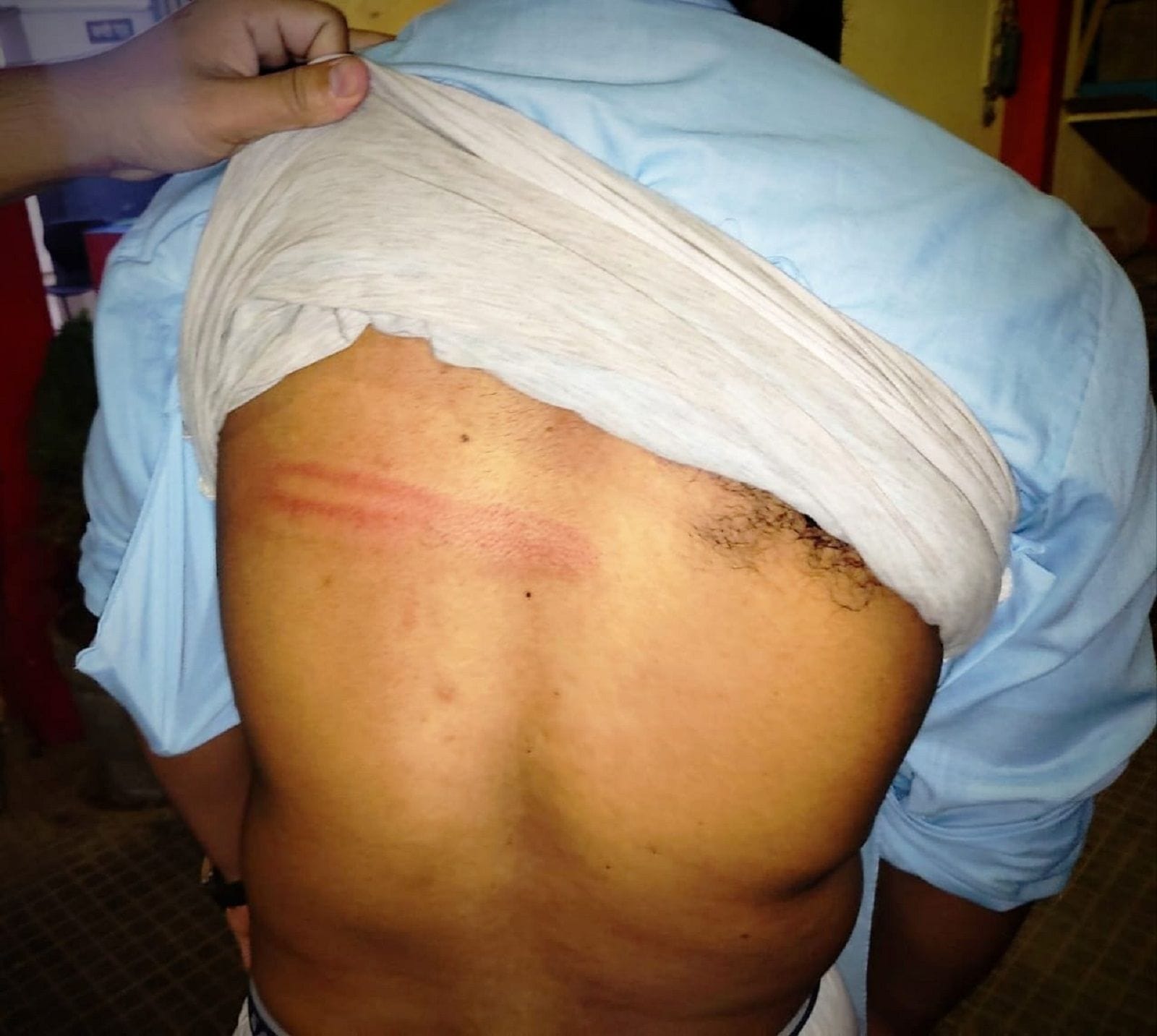 आरपीएफ के जवानों द्वारा पीटे जाने पर चोट दिखाते सादिकउल  इस्लाम ।