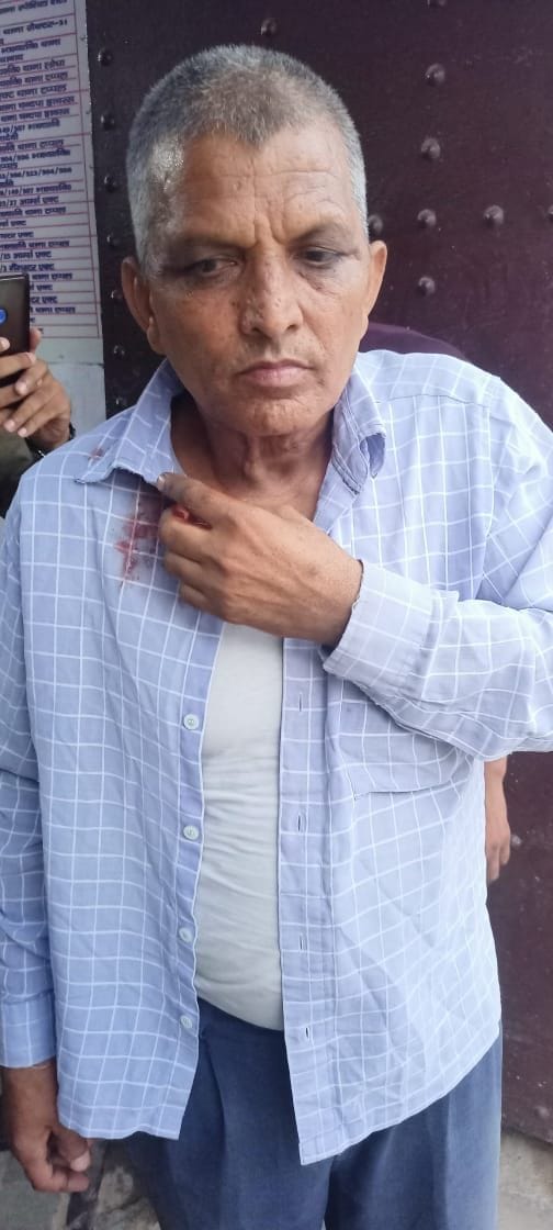 घायल दरोगा किरनपाल। घायल दरोगा किरनपाल।