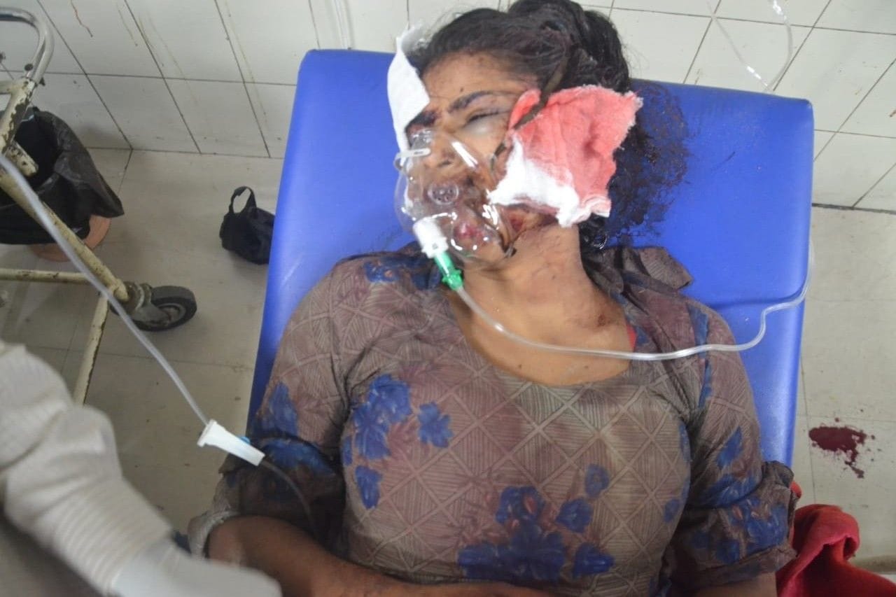 घायल डॉली जेएन मेडिकल में भर्ती।