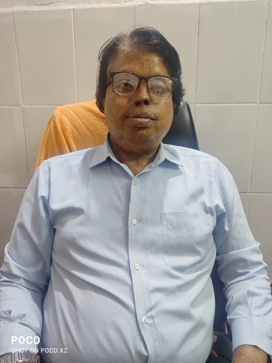एसीएमओ डॉ. शिशिर पुरी। संवाद एसीएमओ डॉ. शिशिर पुरी। संवाद