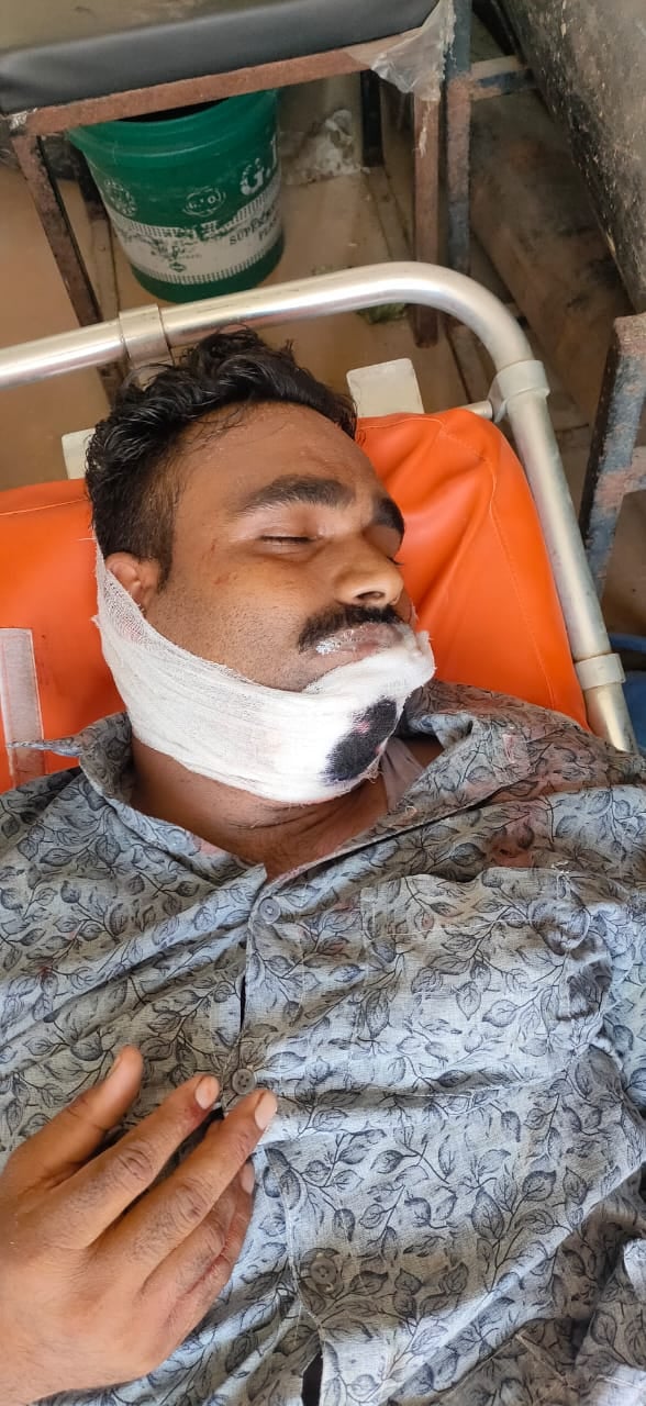 सड़क हादसे में घायल सड़क हादसे में घायल