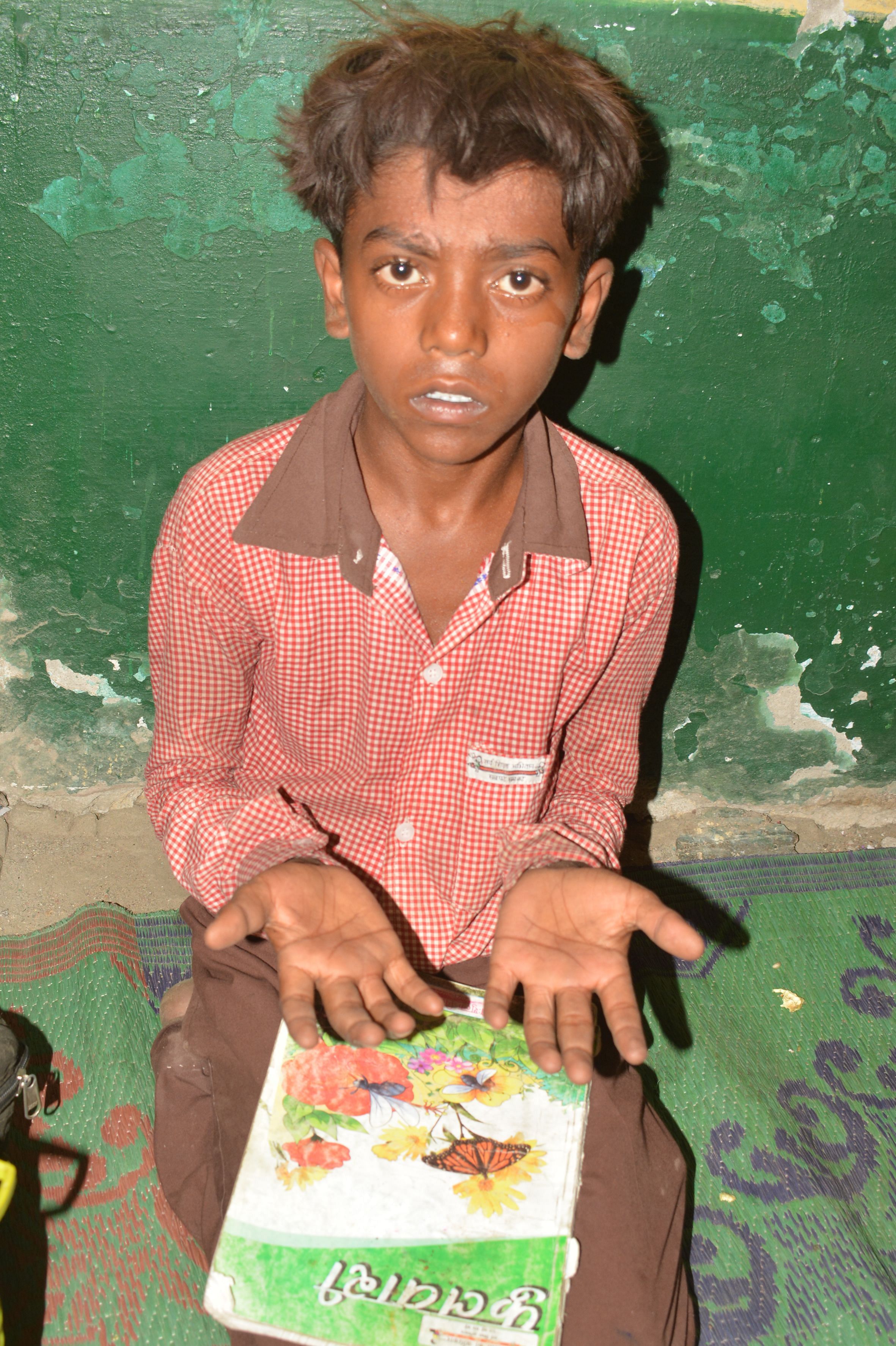 फोटो-06- शिक्षक की पिटाई से घायल हाथ को दिखाता छात्र शिवम फोटो-06- शिक्षक की पिटाई से घायल हाथ को दिखाता छात्र शिवम