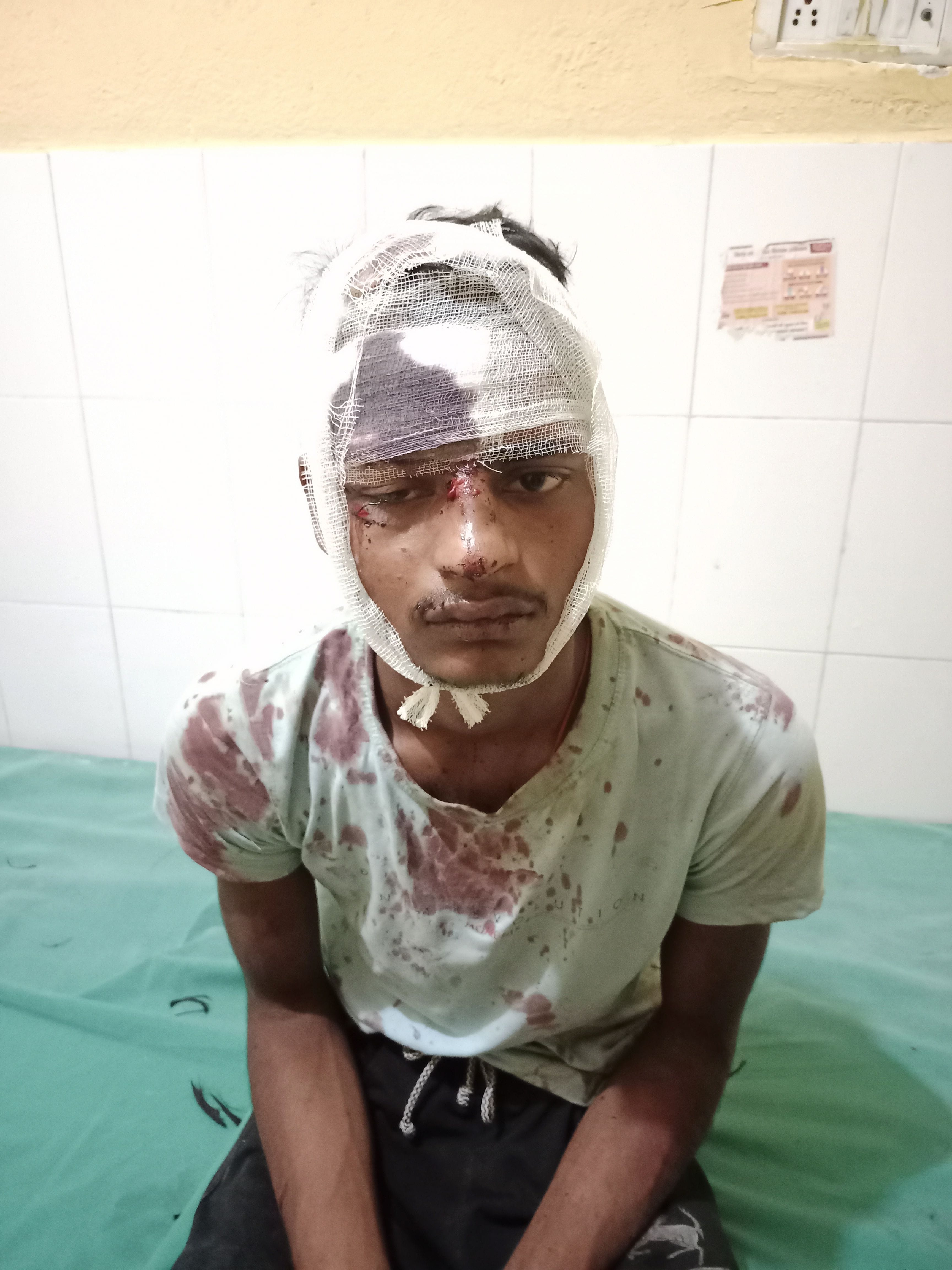 फोटो 21एयूआरपी-36- घायल आकाश। संवाद फोटो 21एयूआरपी-36- घायल आकाश। संवाद