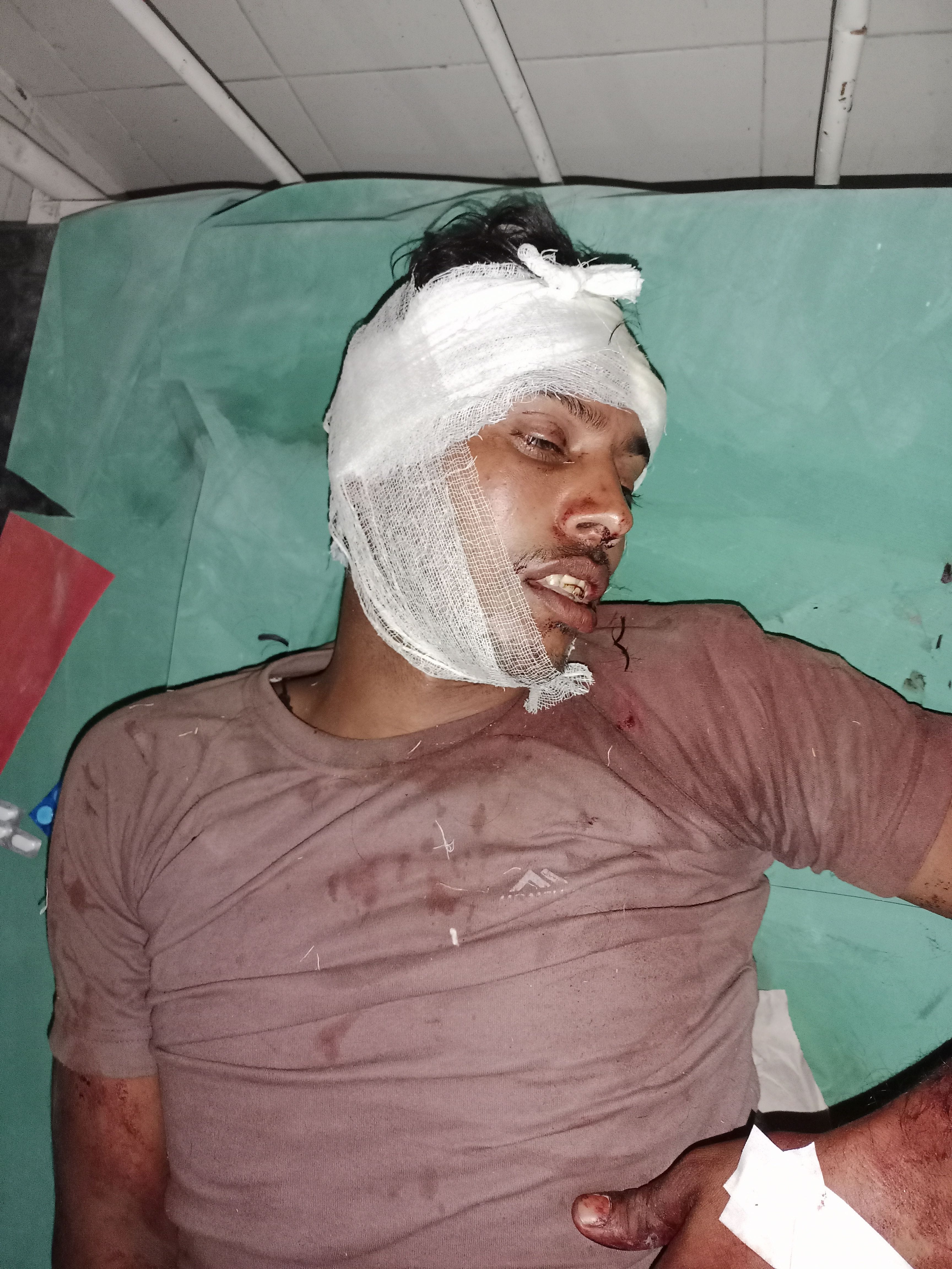 फोटो 21एयूआरपी-38- घायल अनुराग। संवाद फोटो 21एयूआरपी-38- घायल अनुराग। संवाद