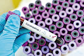 15 new corona cases found in sirmaur district on friday 15 new corona cases found in sirmaur district on friday
