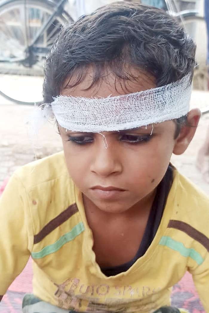 घायल छात्र सलमान। घायल छात्र सलमान।