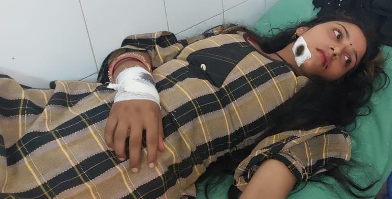 घायल शगुन घायल शगुन