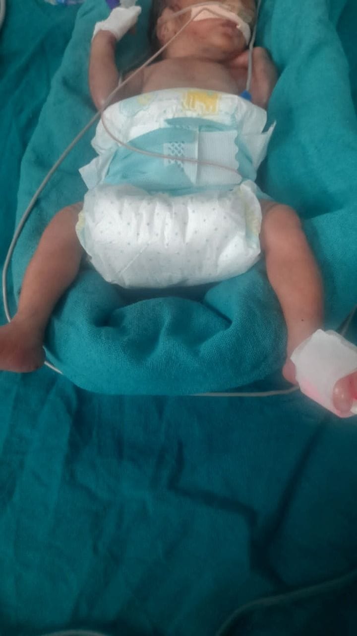 Newborn baby found tied in a bag at the temple gate in Jathlana, hospitalized Newborn baby found tied in a bag at the temple gate in Jathlana, hospitalized