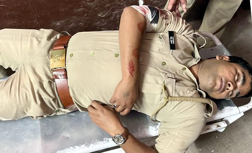 बिजनौर के नगीना में पुलिस और बदमाशों की मुठभेड़ में घायल सिपाही।