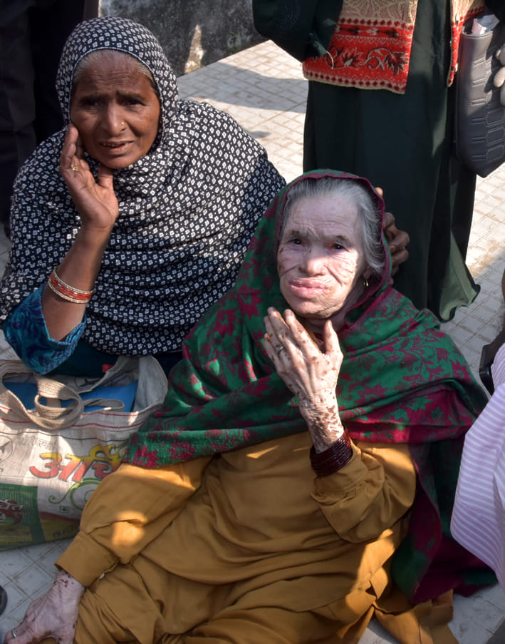 साहरनपुर के राजकीय मेडिकल कॉलेज पर मरीज