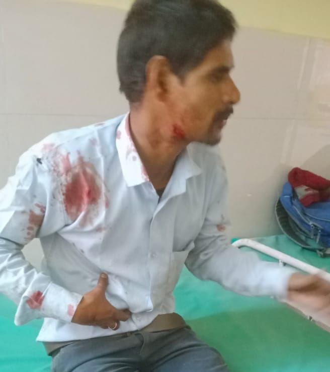 फोटो-20- सीएचसी में मौजूद घायल छात्र फोटो-20- सीएचसी में मौजूद घायल छात्र