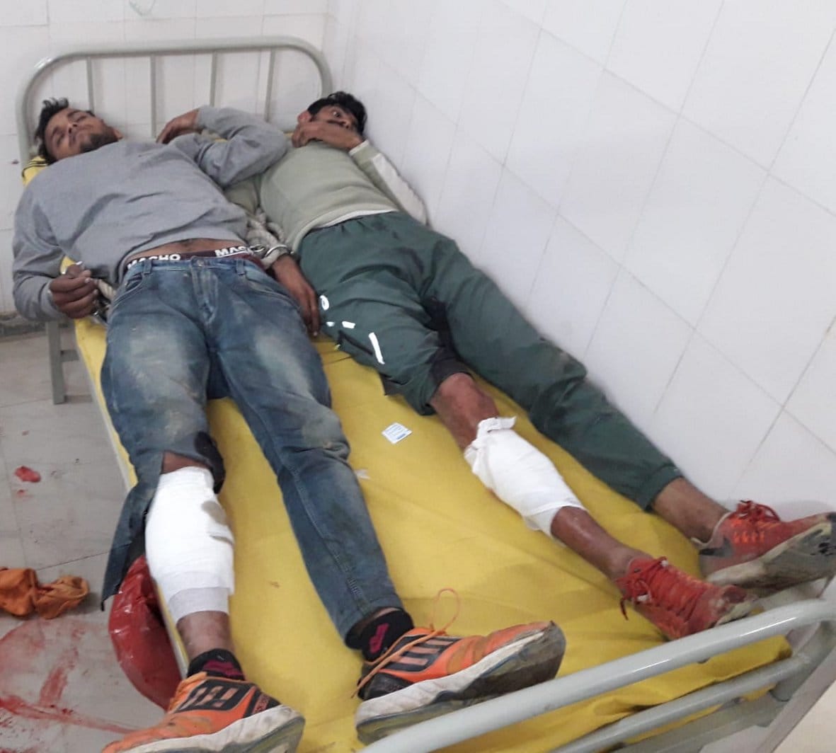 बागपत : खेकड़ा सीएचसी में भर्ती मुठभेड़ के दौरान गोली लगने से घायल हुए आरोपी।
