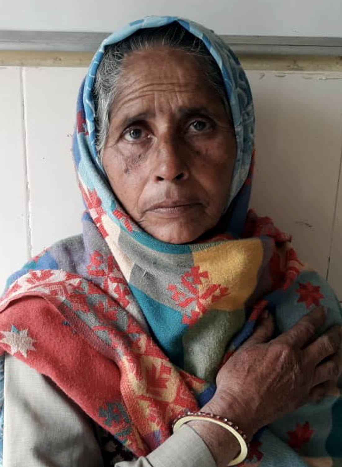 मारपीट में घायल ग्राम निरोजपुर एम्मा निवासी महिला केवती