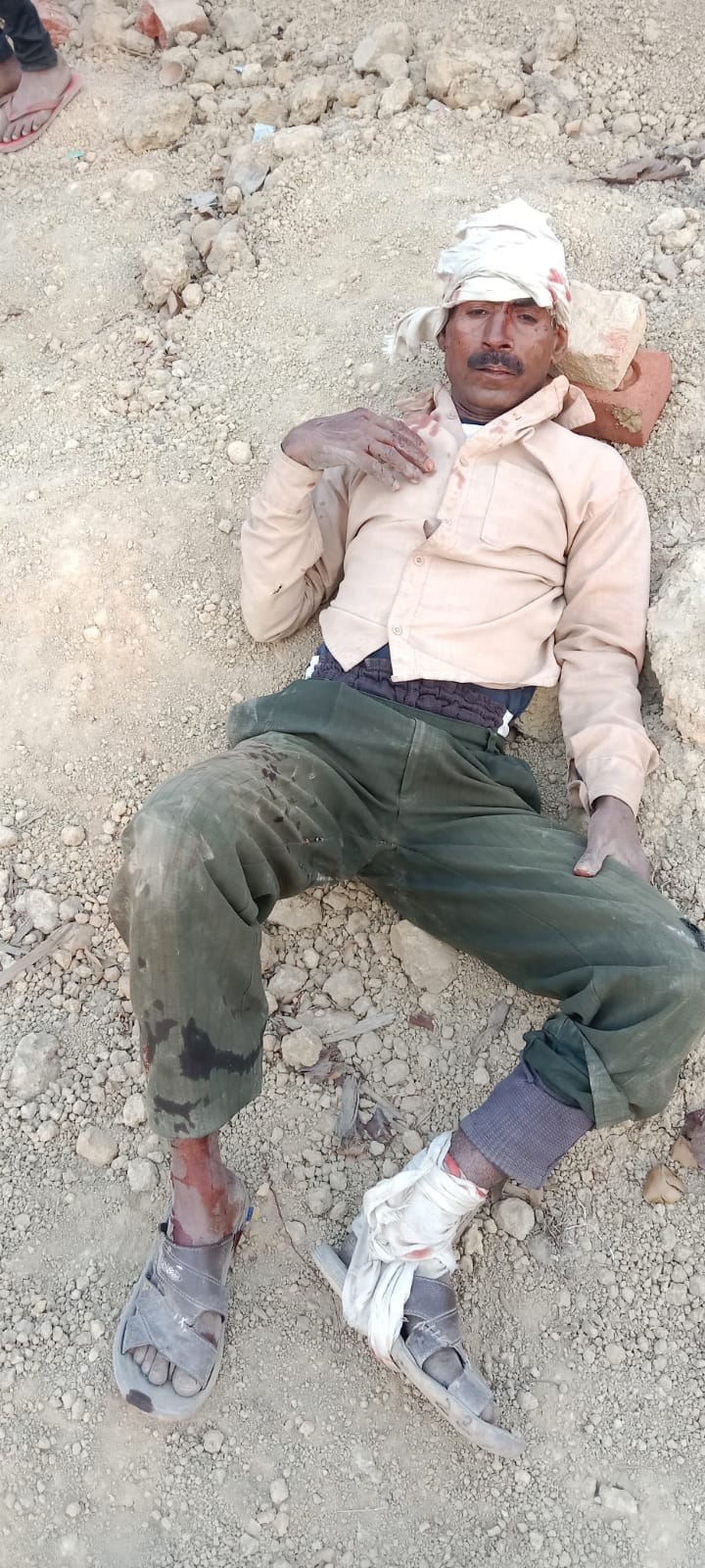 करंजाकला क्षेत्र के जासोपुर में बन रहे ओवरहेड टैंक का छज्जा गिरने से घायल श्रमिक। संवाद