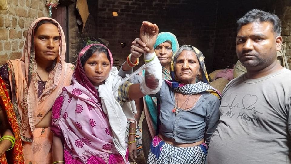घायल मां