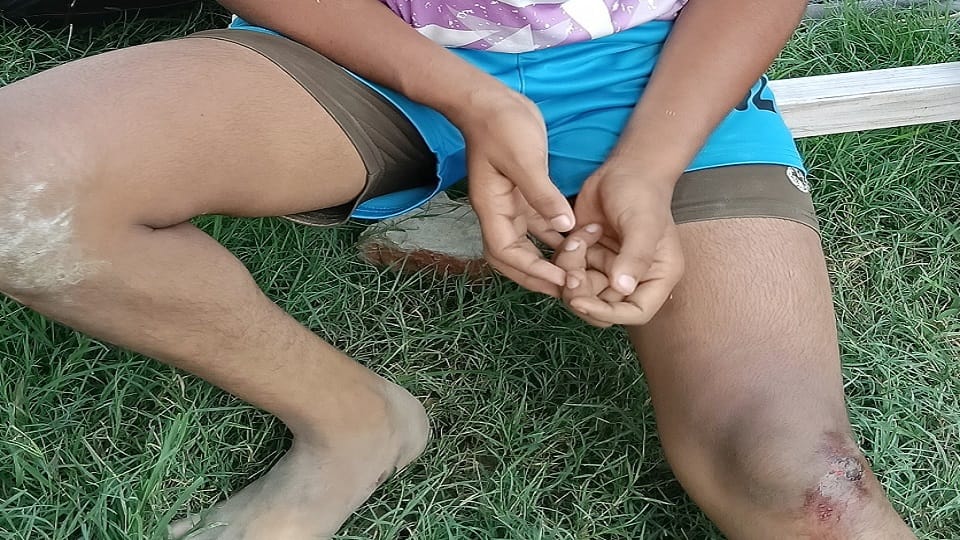 ट्रायल के दौरान घायल हुई खिलाड़ी