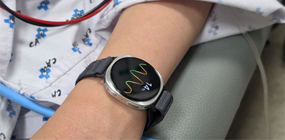 Smartwatch: बेहोश होने से पहले वार्निंग देगी घड़ी, ये कंपनी तैयार कर रही नया स्मार्टवॉच