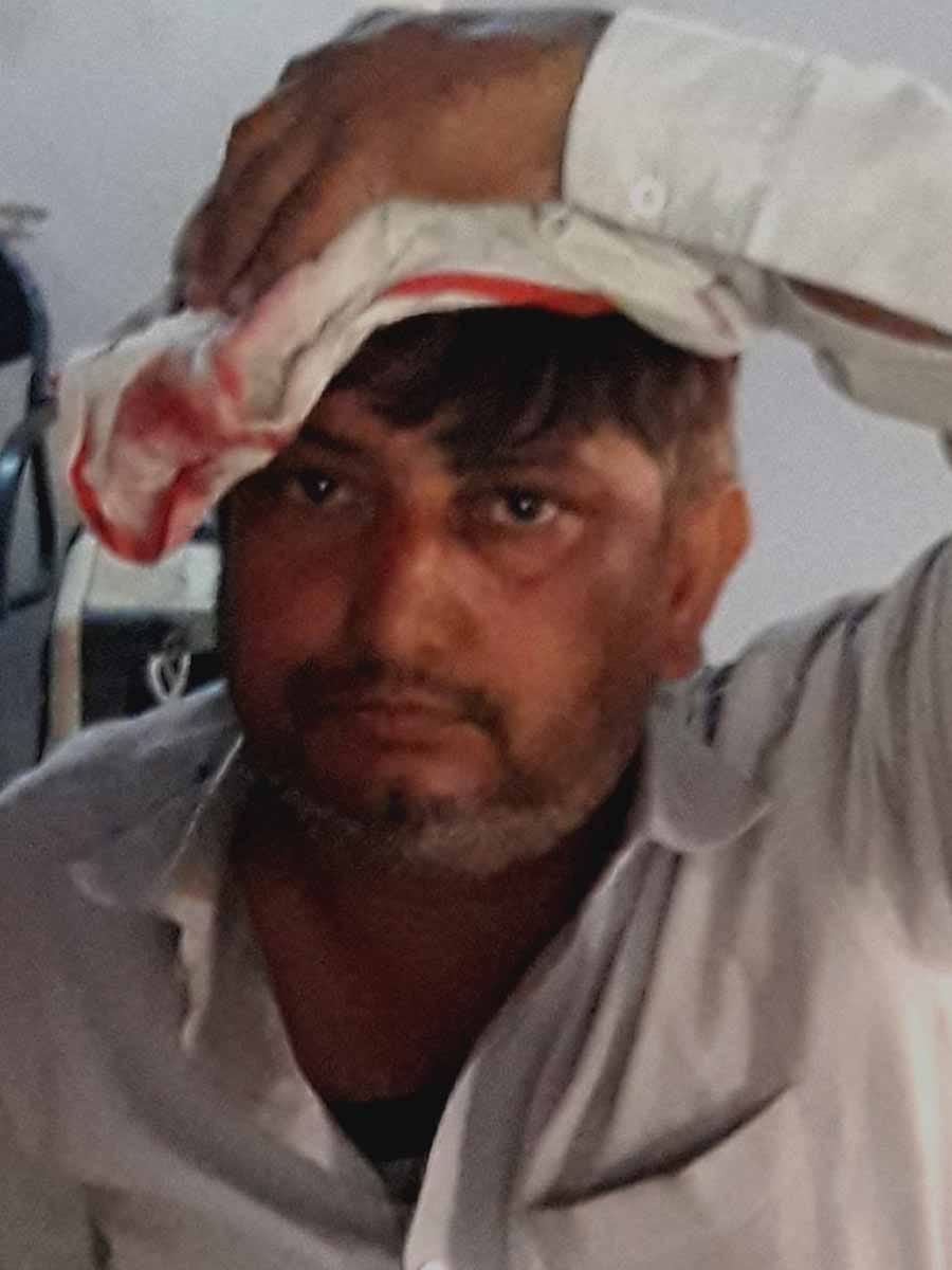 हादसे में घायल लोगों को अस्पताल ले जाती एंबुलेंस हादसे में घायल लोगों को अस्पताल ले जाती एंबुलेंस