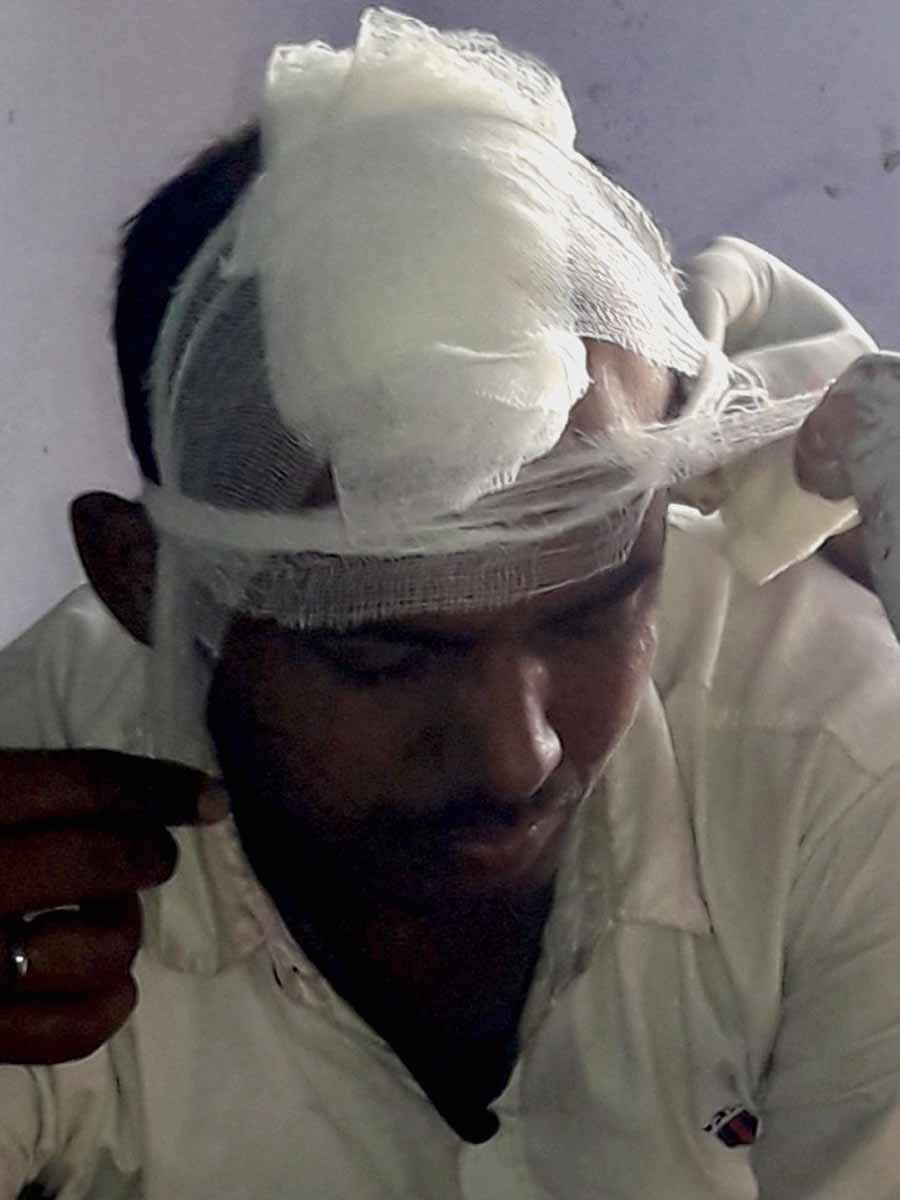 हादसे में घायल लोगों को अस्पताल ले जाती एंबुलेंस हादसे में घायल लोगों को अस्पताल ले जाती एंबुलेंस
