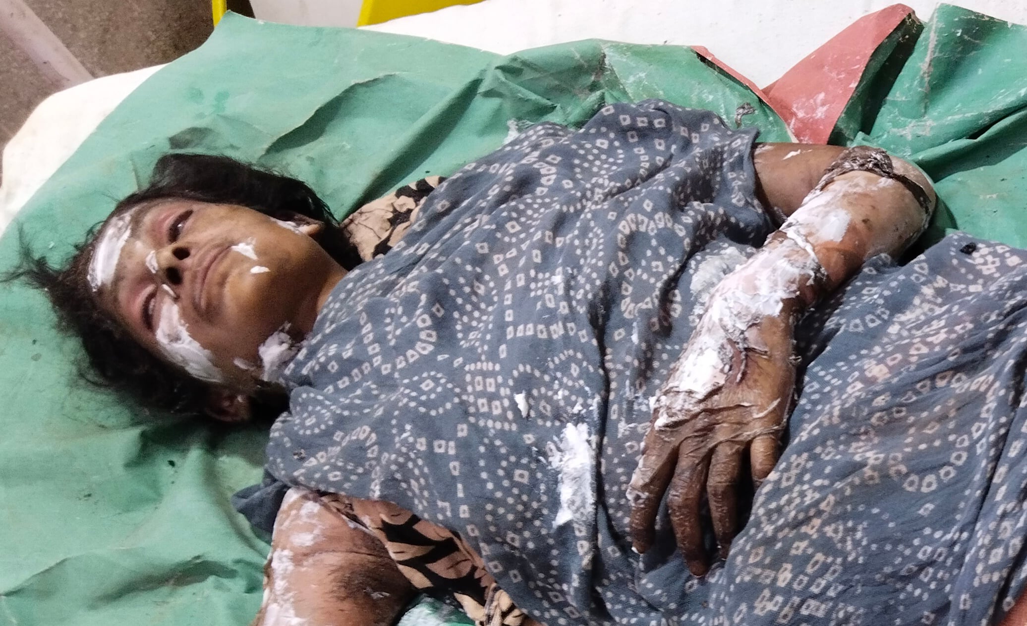 थाना भवन क्षेत्र के गांव मोरमाजरा में पटाखा फैक्ट्री में आग का बुझाते अग्नी शमन दल के कर्म थाना भवन क्षेत्र के गांव मोरमाजरा में पटाखा फैक्ट्री में आग का बुझाते अग्नी शमन दल के कर्म