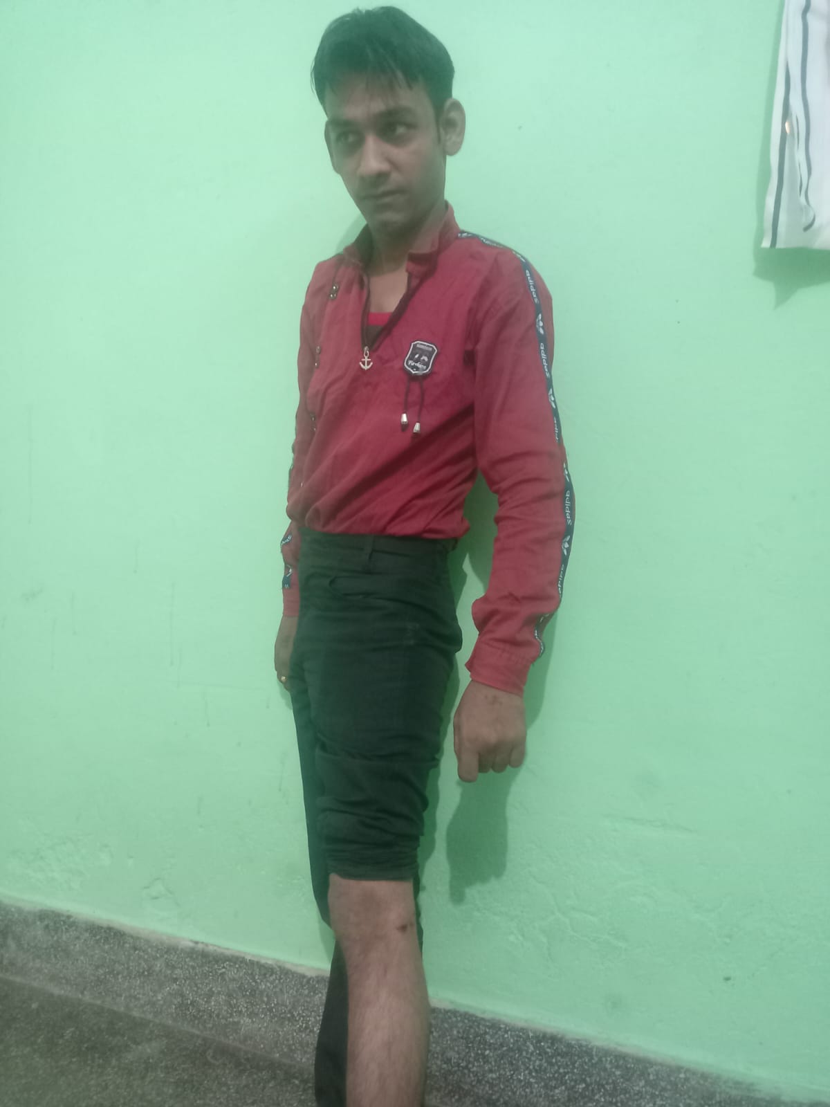थाना भवन में पागल कुत्ते के हमले में घायल बच्चा थाना भवन में पागल कुत्ते के हमले में घायल बच्चा