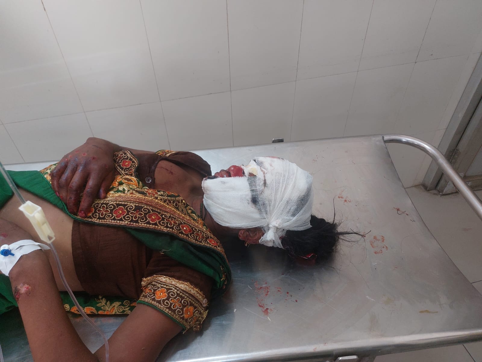 जिला अस्पताल में भर्ती मासूम। संवाद