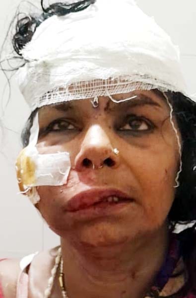 चांदपुर में हुए फायरिग  में घायल प्रीति देवी