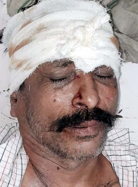 चांदपुर में हुए फायरिग  में घायल प्रीति देवी