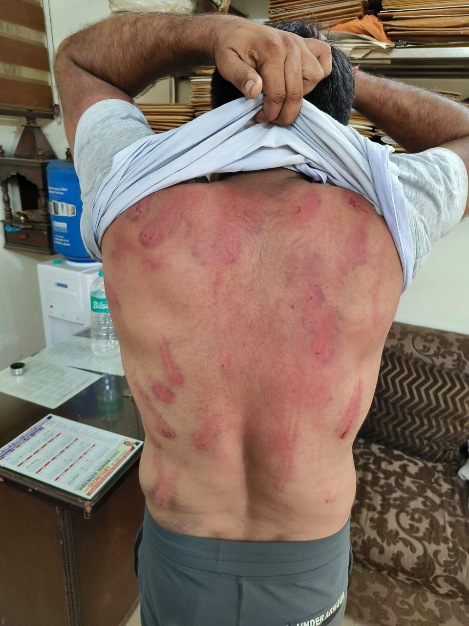 फोटो :49: सोनीपत से अपहरण के बाद पिटाई से बुरी तरह घायल ऑटो पार्ट्स दुकानदार। फोटो :49: सोनीपत से अपहरण के बाद पिटाई से बुरी तरह घायल ऑटो पार्ट्स दुकानदार।