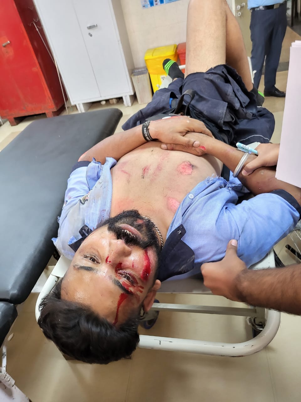 एसडी कॉलेज के पास हुए हादसे में घायल युवक - संवाद एसडी कॉलेज के पास हुए हादसे में घायल युवक - संवाद