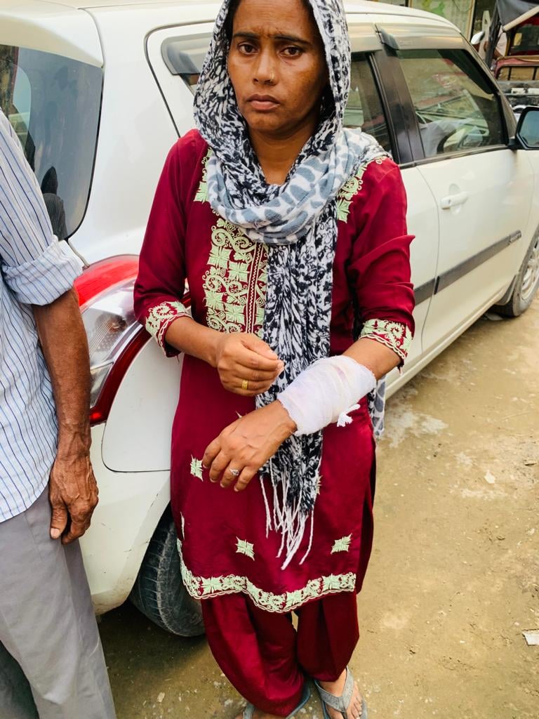 सूर्य नगर में हुई मारपीट के दौरान घायल महिला - संवाद सूर्य नगर में हुई मारपीट के दौरान घायल महिला - संवाद