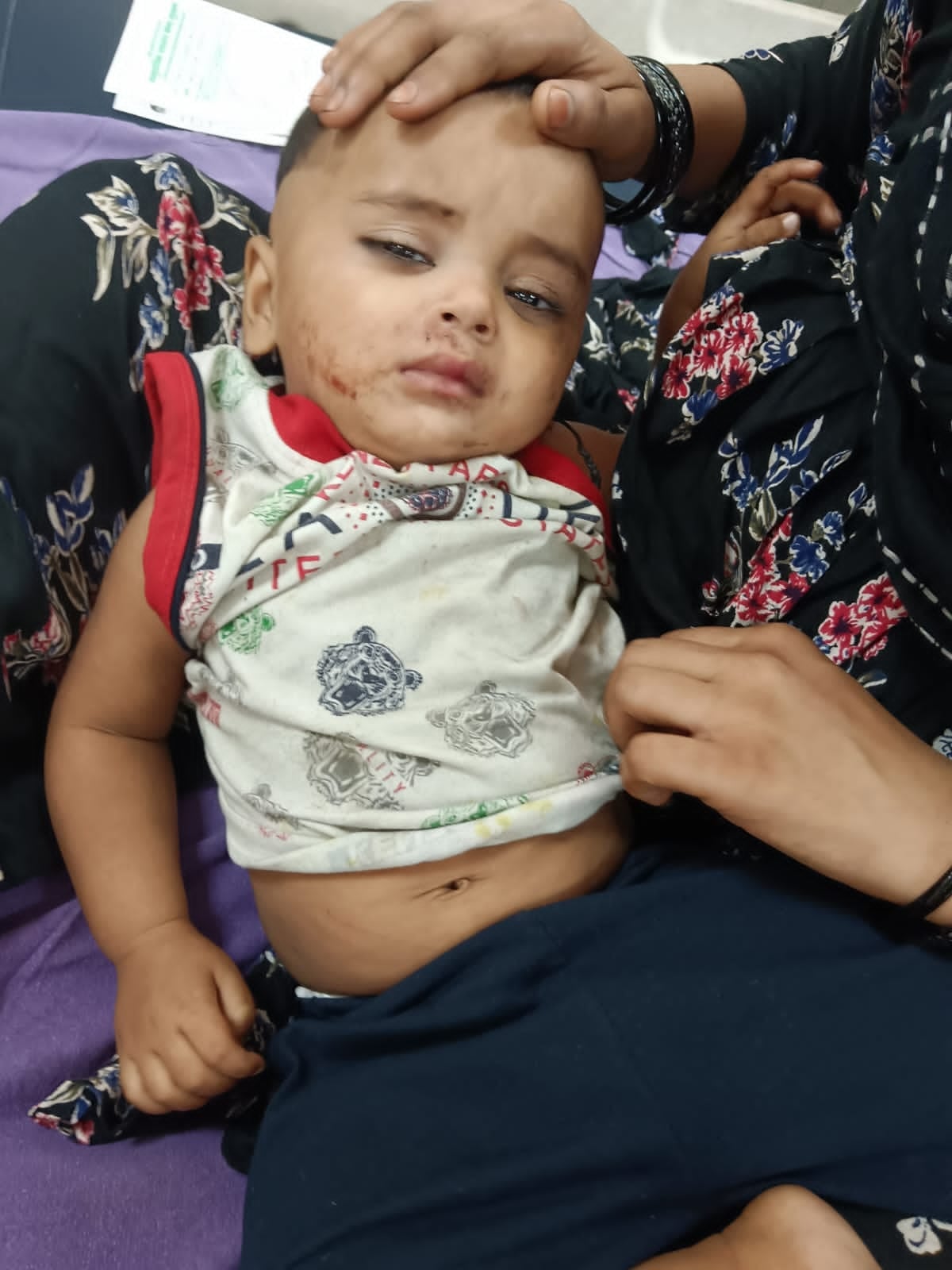 नागरिक अस्पताल में घायल बच्ची उपचाराधीन नागरिक अस्पताल में घायल बच्ची उपचाराधीन