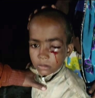 नजीबाबाद - घायल सीताराम। नजीबाबाद - घायल सीताराम।