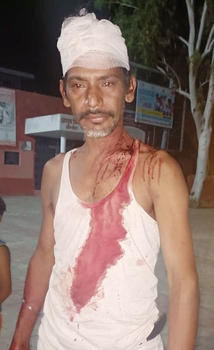 फोटो :36: घायल सब्जी विक्रेता विजय फोटो :36: घायल सब्जी विक्रेता विजय