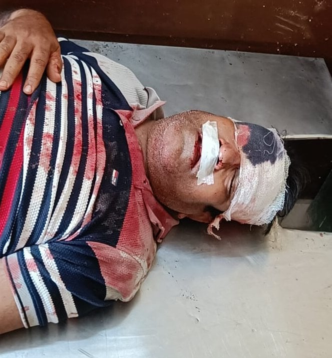 लीलापुर थाने के तिना चितरी गांव के समीप राजमार्ग पर आमने सामने टकराई कार व ट्रैक्टर। संवाद लीलापुर थाने के तिना चितरी गांव के समीप राजमार्ग पर आमने सामने टकराई कार व ट्रैक्टर। संवाद