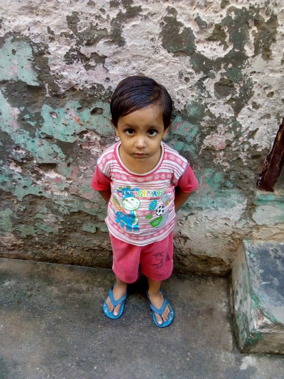 झिंझाना कुत्तों के हमले से घायल मासूम बच्च झिंझाना कुत्तों के हमले से घायल मासूम बच्च