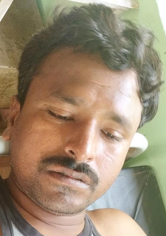 उझानी में घायल बदमाश गौर सिंह। संवाद