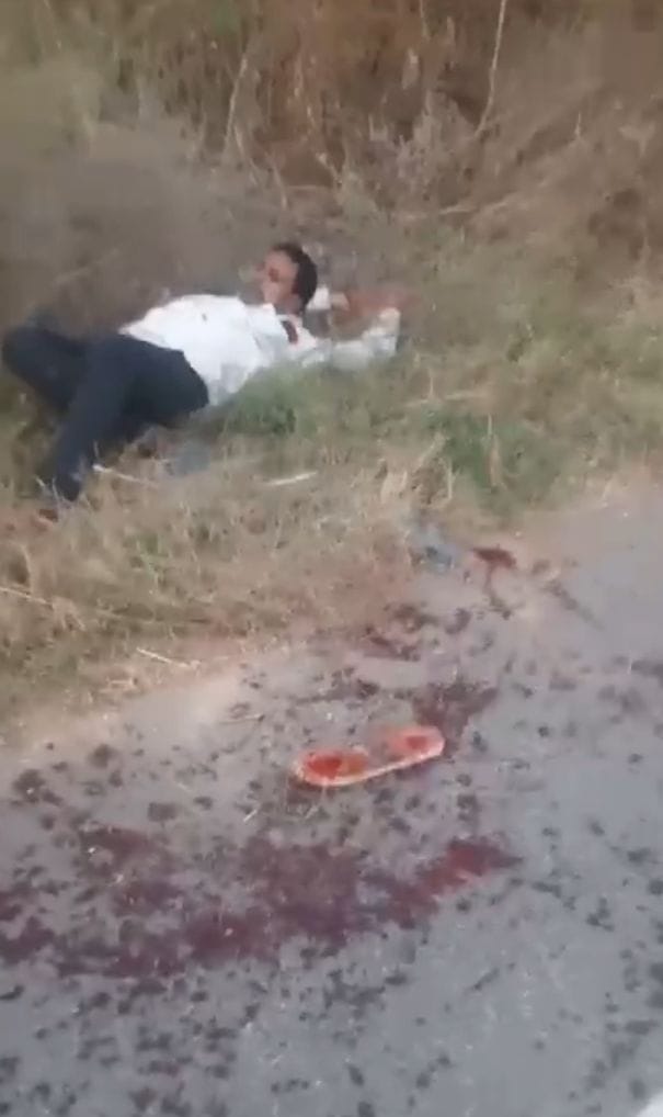 हमले में घायल रोशनी देवी के हाथ से बहता खून रोकने का प्रयास करती महिला। हमले में घायल रोशनी देवी के हाथ से बहता खून रोकने का प्रयास करती महिला।