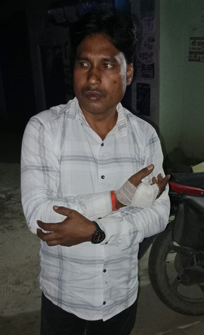 घायल राजू यादव सेल्समैन। घायल राजू यादव सेल्समैन।