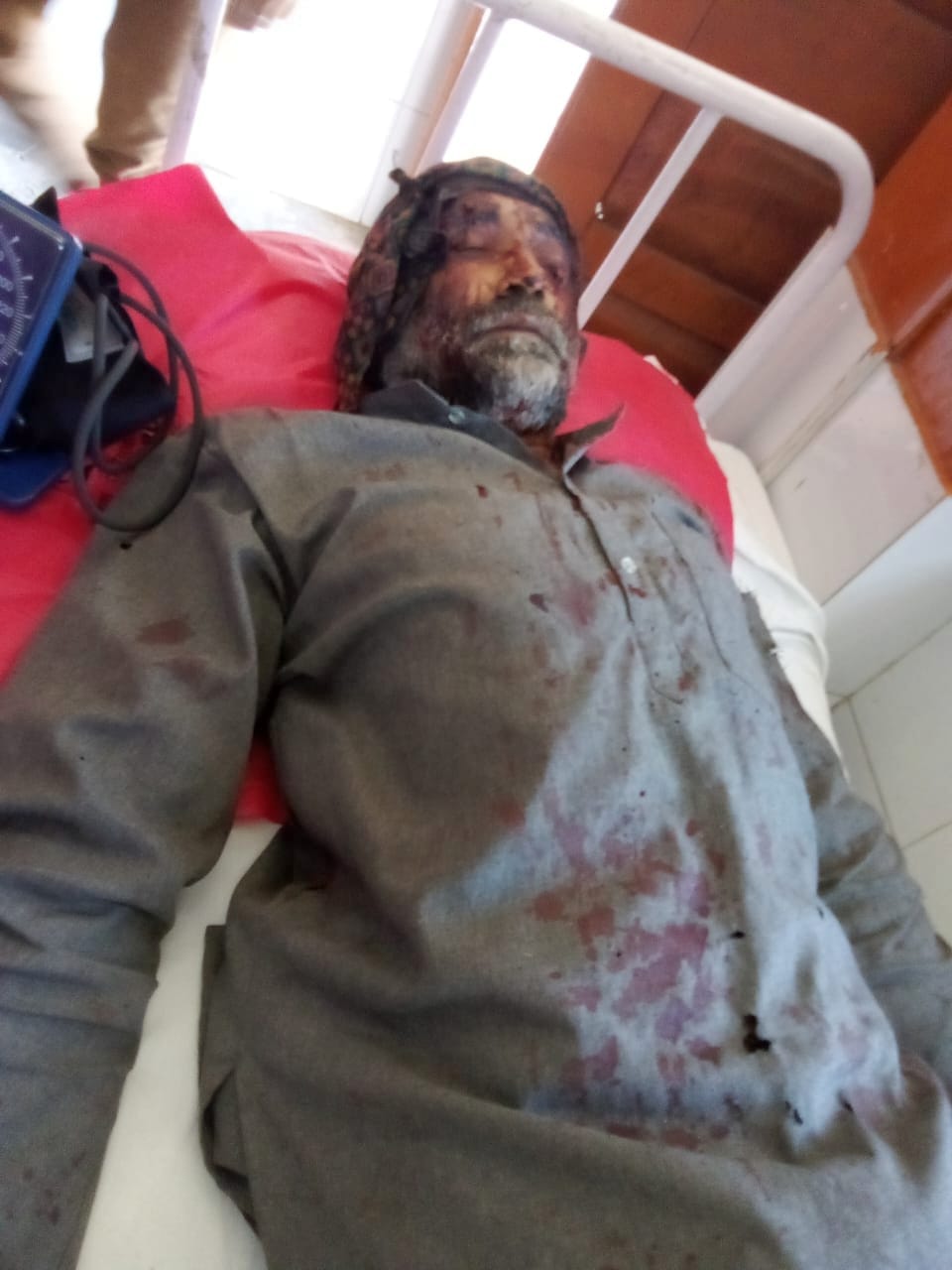 नौहराधार अस्पताल में तेंदुए के हमले से घायल भीम सिंह को प्राथमिक उपचार देते चिकित्सक। संवाद नौहराधार अस्पताल में तेंदुए के हमले से घायल भीम सिंह को प्राथमिक उपचार देते चिकित्सक। संवाद