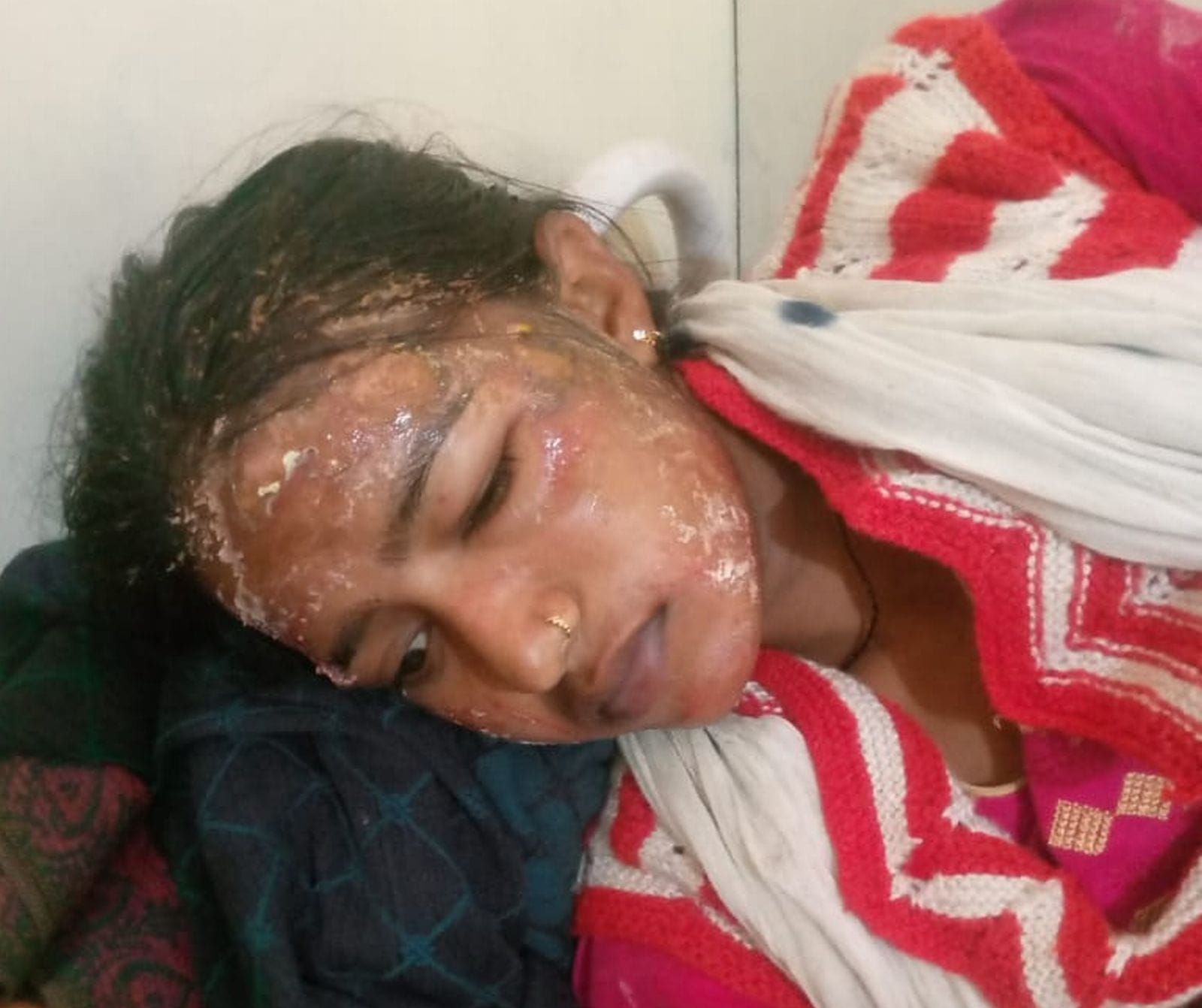 थलिया नगला में पशुशाला में लगी आग । संवाद