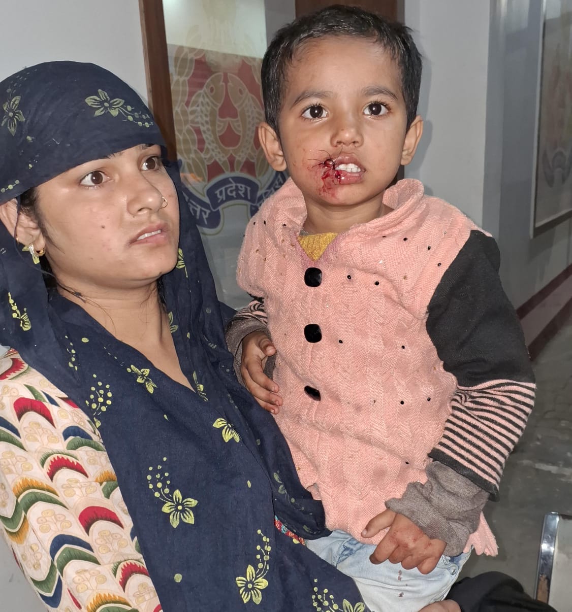 खुर्जा के नया गंज मोहल्ले में कुत्ते के काटने के बाद घायल बच्ची अपनी मां के साथ। - संवाद खुर्जा के नया गंज मोहल्ले में कुत्ते के काटने के बाद घायल बच्ची अपनी मां के साथ। - संवाद